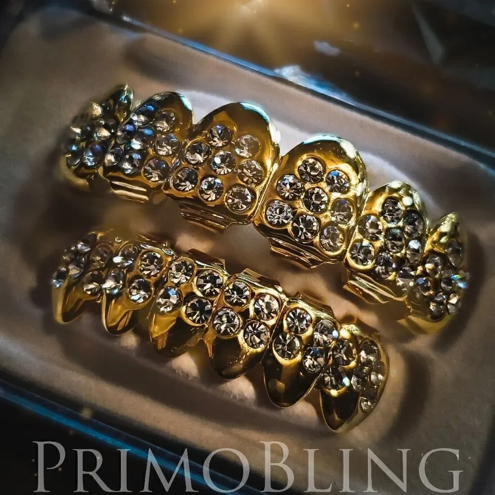 Standard Gold Grillz Set